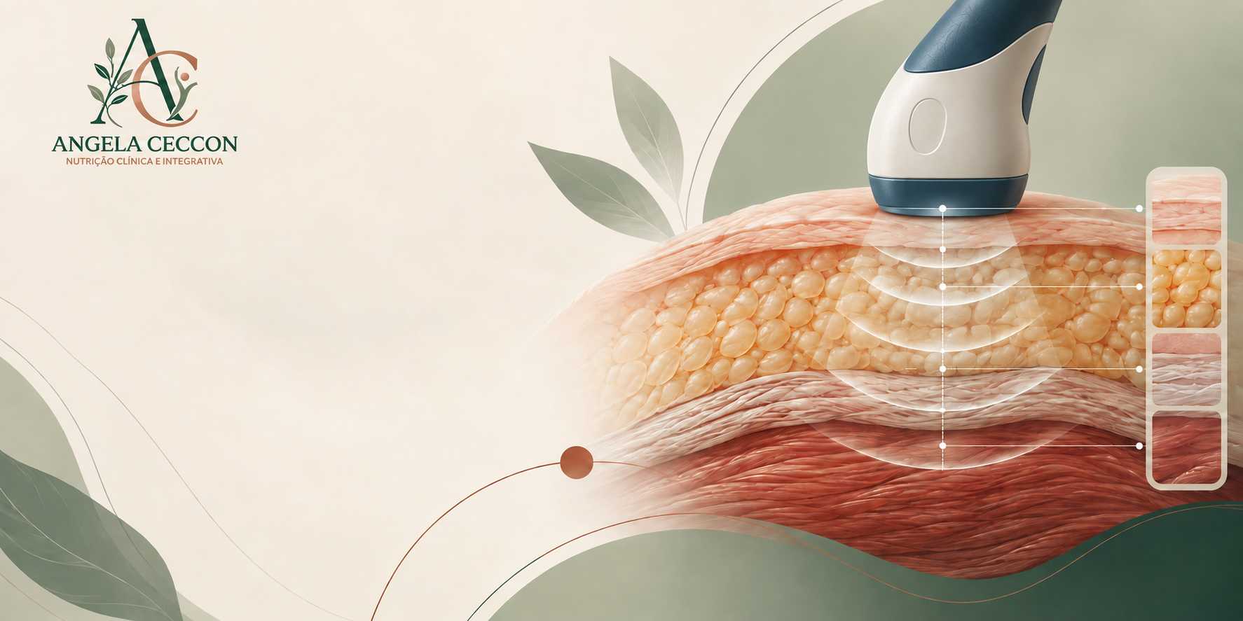Ilustração técnica do ultrassom BodyMetrix atravessando camadas de pele, gordura e músculo